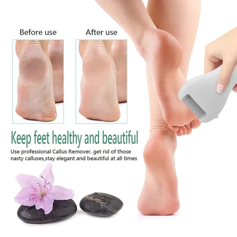 Ergonomic Foot Callus Remover with Digital Display